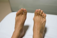 Definition and Facts About Bunions