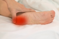 Plantar Fasciitis Is the Most Likely Cause of Heel Pain