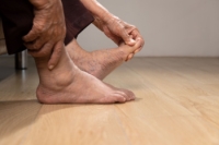 Symptoms and Stages of Gout