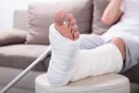 Healing of a Broken Ankle