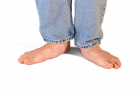 Types and Causes of Flat Feet
