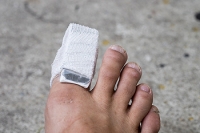 Why a Podiatrist Should Look at Your Broken Toe